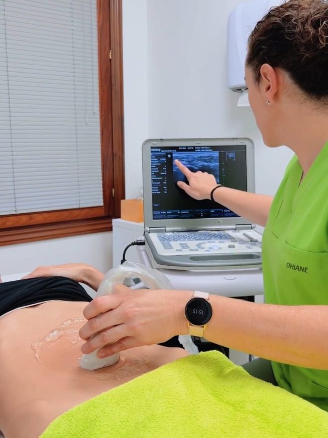 Ecografia funcional en Diastasis