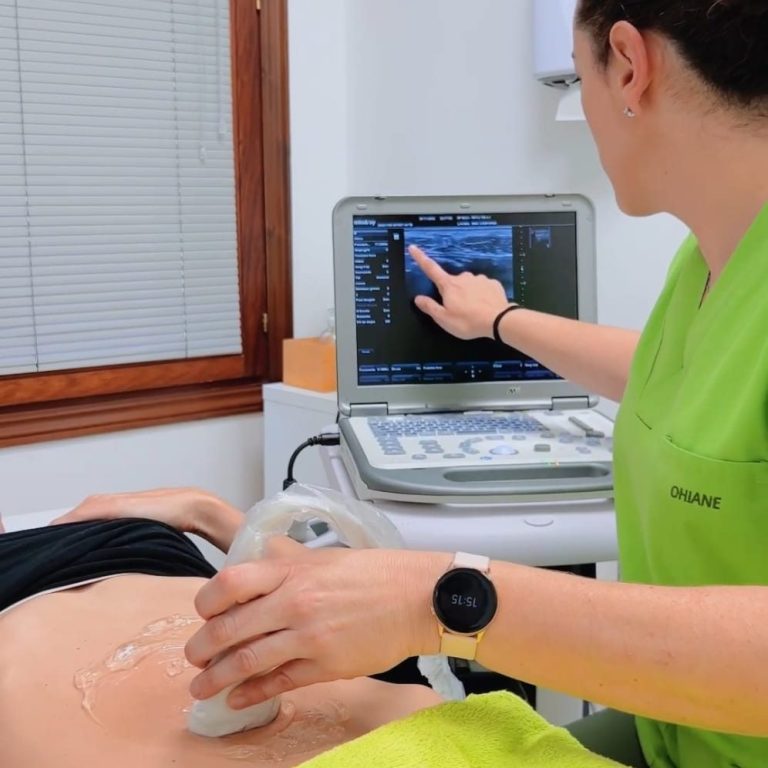 Ecografia funcional en Diastasis Ecografia funcional en Diastasis