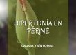 Hipertonía en suelo Pélvico. Fisioterapia en Bilbao